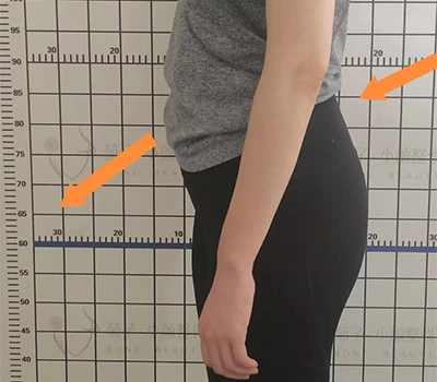 Kev ntsuam xyuas tom qab Pelvic Tilt Assessment: Clinical Insight, Commercial Value, and Correcti...