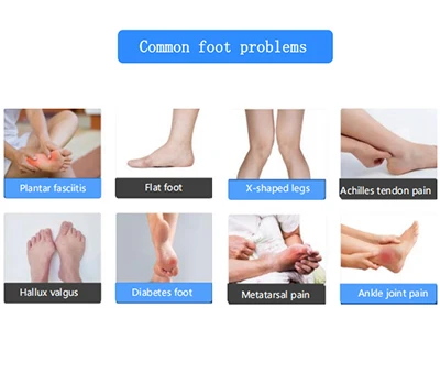 Hloov kho ko taw kev saib xyuas: xianku's 3D ko taw scanner hloov tau orthopedics thiab ko taw ke...