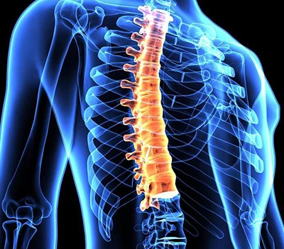 Ntshoo kho kom zoo: Yuav ua li cas xianku3d lub cev scanner yog hloov kev mob spinalcare